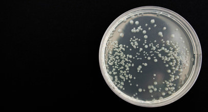 Candida albicans – Ursachen, Symptome, Behandlung und Vorbeugung der Candida-Infektion