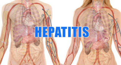 Hepatitis – die heimtückische Leberentzündung